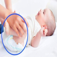 הימנע מהפעולה השגויה של החלפת החיתולים של התינוק (1)